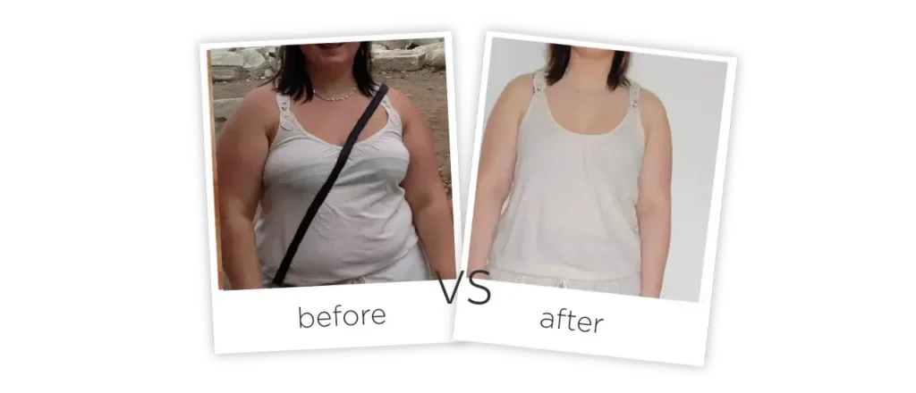 Cold-Slimming-3